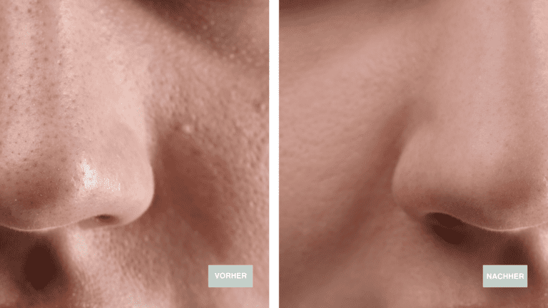 Kopie von VorherNachher LP (2560 × 1440 px)-18