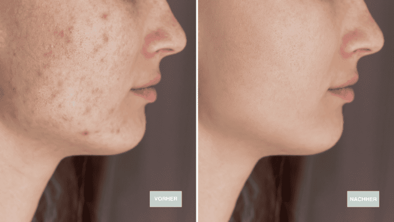 Kopie von VorherNachher LP (2560 × 1440 px)-22