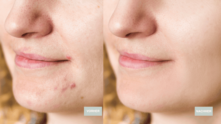 Kopie von VorherNachher LP (2560 × 1440 px)-25